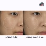 سرم ضد لک و روشن کننده ویتامین سی شماره 5 نامبوزین - 3