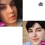 پک تخفیفی ضد جوش و سفیدی (فروزن+صابون) - 8