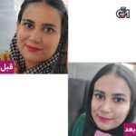 پک تخفیفی سفیدی و ضد جوش(لزل+منجمد+صابون) - 9