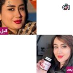 اینفینیتی سفید کننده و کلاژن ساز پوست - 3