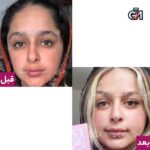 پک تخفیفی شفاف کننده و کلاژن ساز(لزل+آبمیوه) - 4