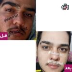 پک تخفیفی سفیدی ضدجوش بالای 25 سال (اینفینیتی+منجمد) - 6