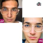 پک تخفیفی روشن کننده ضد جوش مناسب تا 25سال - 8